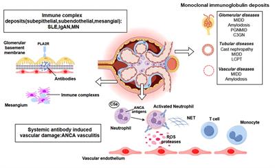 Current progress in CAR-based therapy for kidney disease